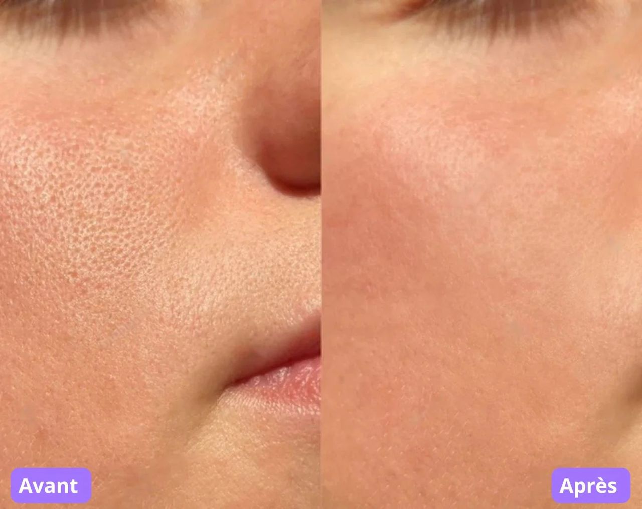 MASQUE DE BEAUTE LED ANTI AGE